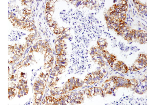 Immunohistochemistry Image 2: Mcl-1 (D5V5L) Rabbit mAb (BSA and Azide Free)