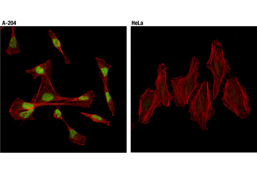 Immunofluorescence Image 1: Sox9 (D8G8H) Rabbit mAb (Alexa Fluor® 488 Conjugate)