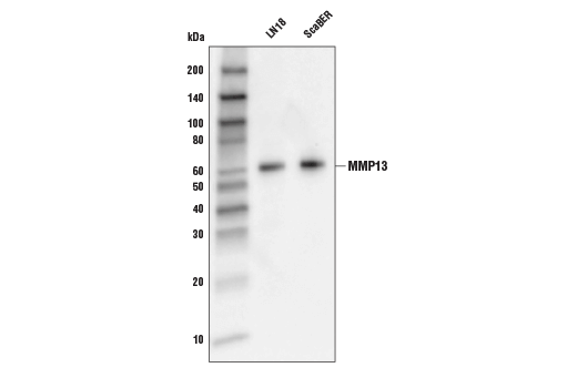 Western Blotting Image 1: MMP-13 Antibody