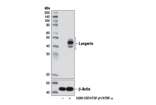 Western Blotting Image 2: Langerin Antibody