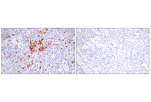 Immunohistochemistry Image 3: CSF-1R/M-CSF-R (E4T8Z) Rabbit mAb (BSA and Azide Free)