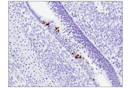  Image 30: Mouse Reactive Cell Death and Autophagy Antibody Sampler Kit