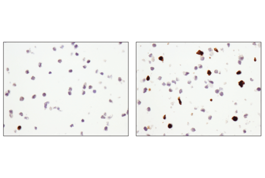 Immunohistochemistry Image 3: Cleaved PARP (Asp214) (D6X6X) Rabbit mAb