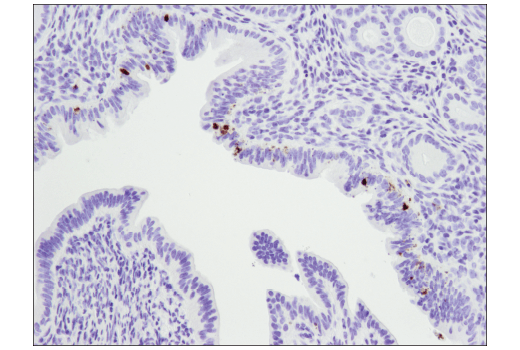 Immunohistochemistry Image 4: Cleaved PARP (Asp214) (D6X6X) Rabbit mAb