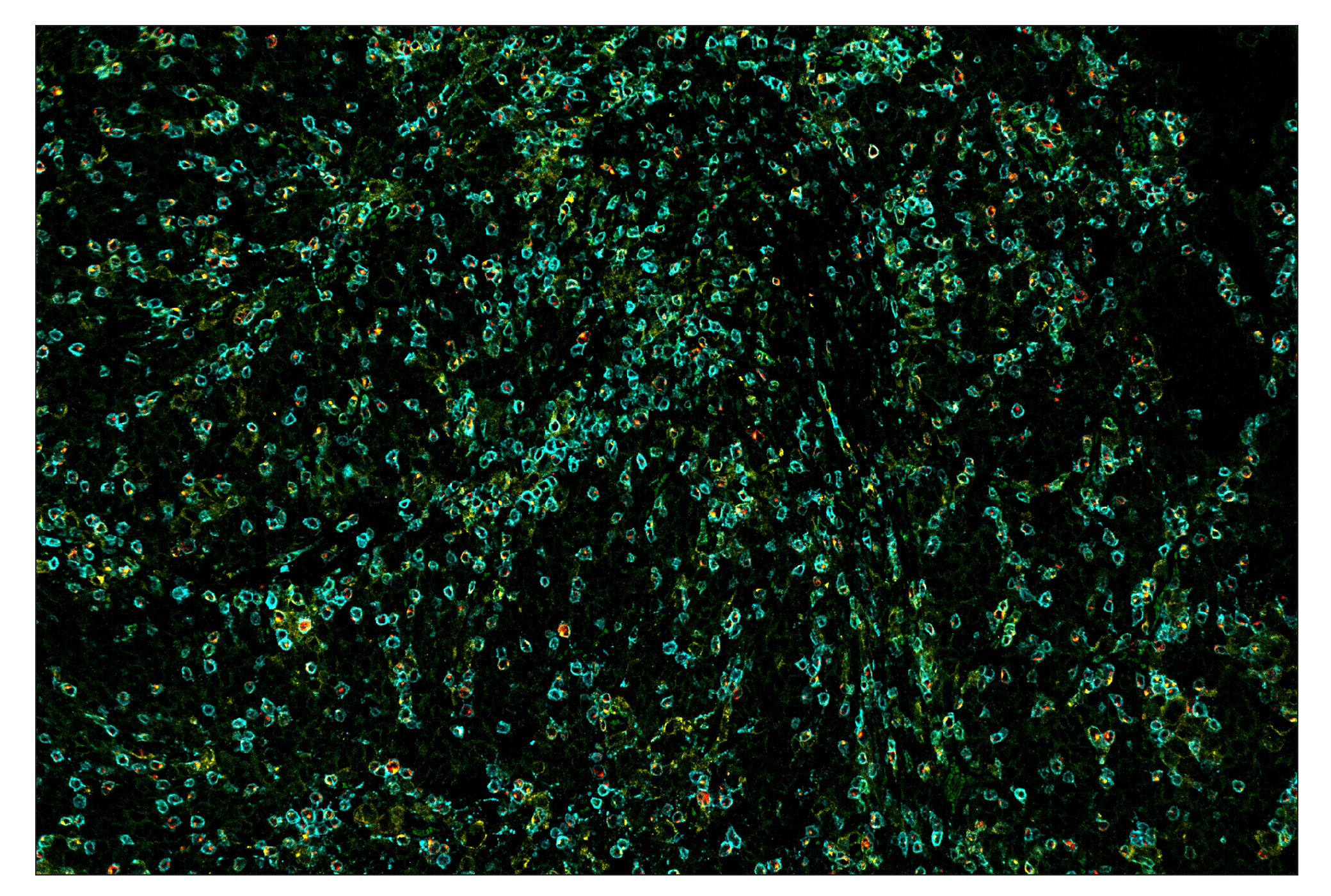Immunohistochemistry Image 7: LAG3 (D2G4O™) & CO-0026-647 SignalStar™ Oligo-Antibody Pair