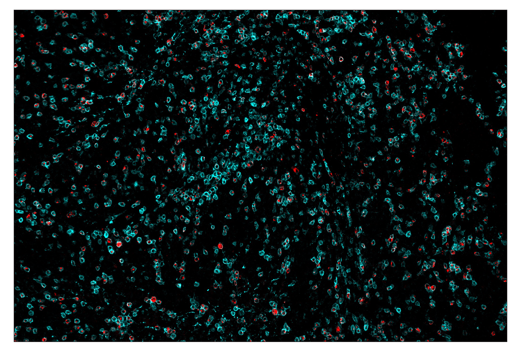 Immunohistochemistry Image 8: LAG3 (D2G4O™) & CO-0026-488 SignalStar™ Oligo-Antibody Pair
