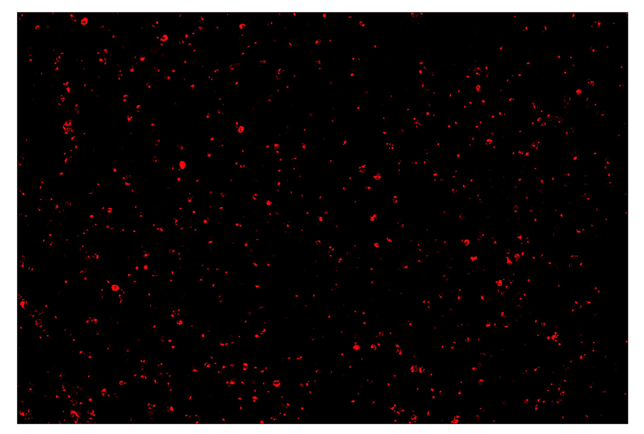 Immunohistochemistry Image 4: LAG3 (D2G4O™) & CO-0026-647 SignalStar™ Oligo-Antibody Pair