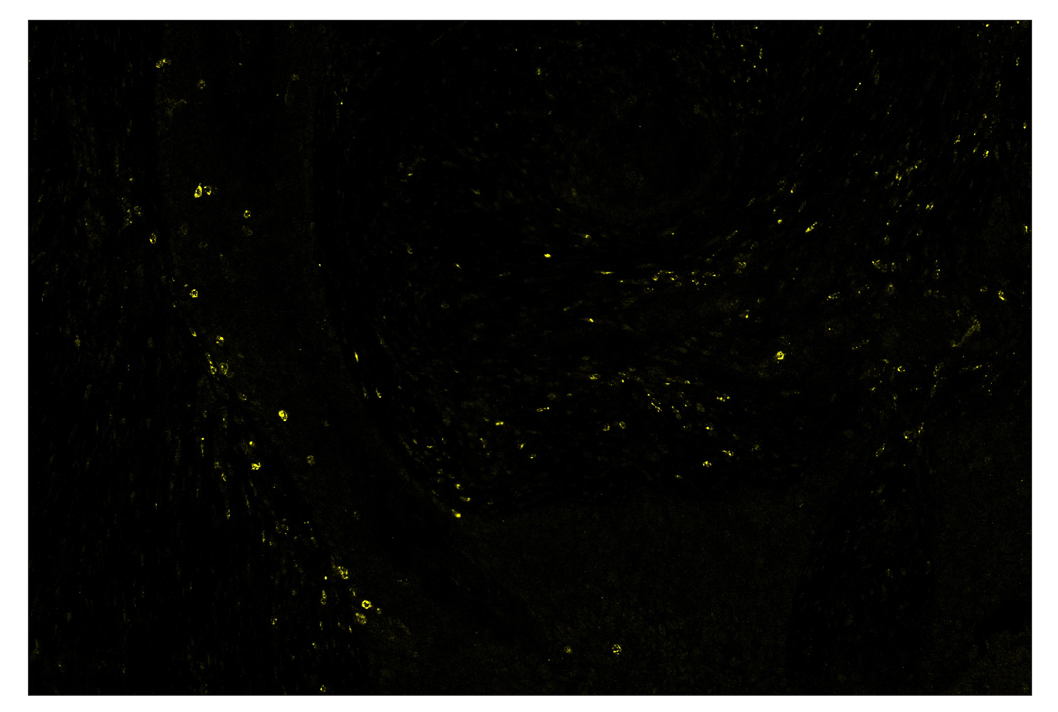 Immunohistochemistry Image 3: LAG3 (D2G4O™) & CO-0026-594 SignalStar™ Oligo-Antibody Pair