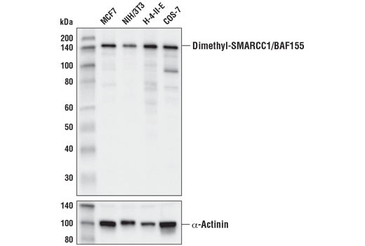 Western Blotting Image 1: Asymmetric Dimethyl-SMARCC1/BAF155 (Arg1064) (D8I3U) Rabbit mAb