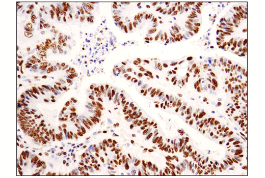 Immunohistochemistry Image 1: Asymmetric Dimethyl-SMARCC1/BAF155 (Arg1064) (D8I3U) Rabbit mAb