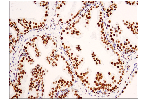 Immunohistochemistry Image 3: Asymmetric Dimethyl-SMARCC1/BAF155 (Arg1064) (D8I3U) Rabbit mAb