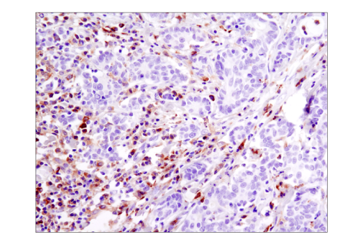 Immunohistochemistry Image 5: Btk (D3H5) Rabbit mAb (BSA and Azide Free)
