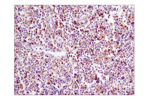 Immunohistochemistry Image 2: Btk (D3H5) Rabbit mAb (BSA and Azide Free)