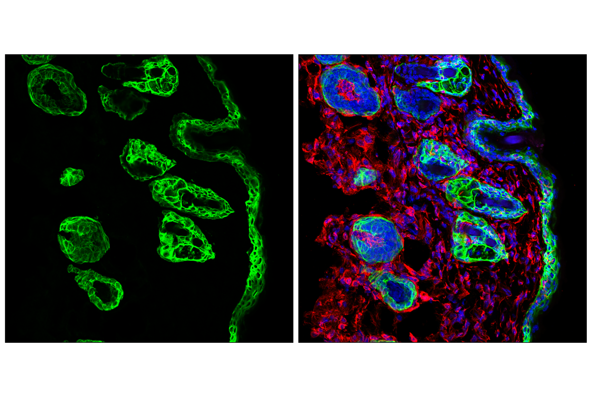 Immunofluorescence Image 1: Keratin 14 (E7W6V) Rabbit mAb (BSA and Azide Free)