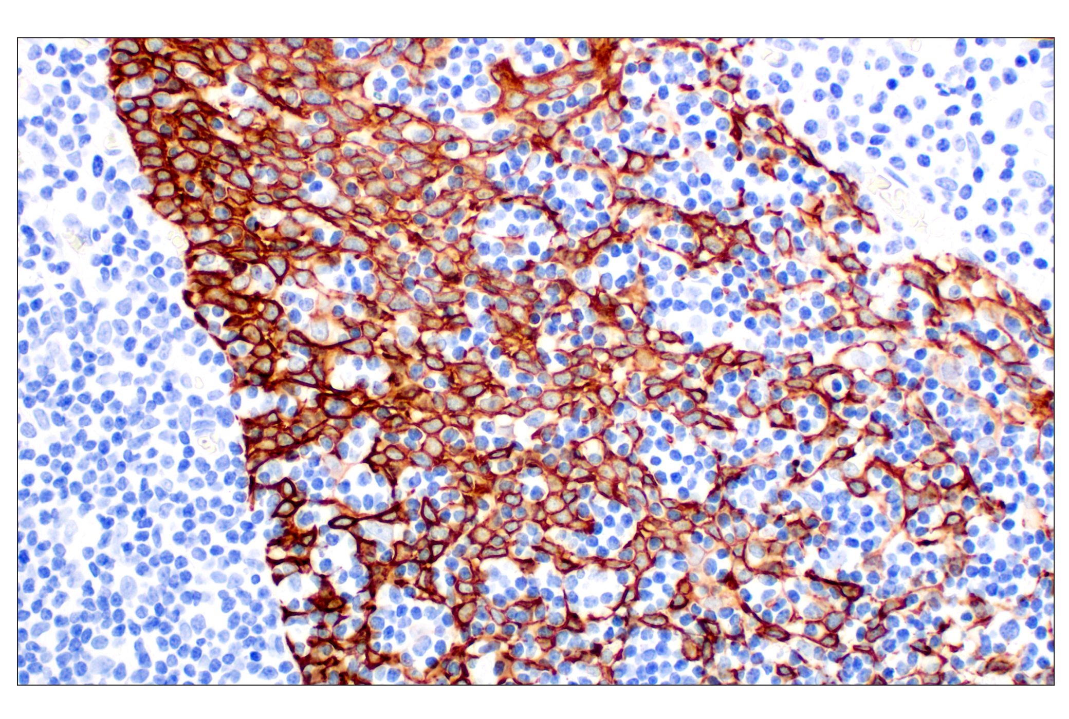 Immunohistochemistry Image 5: Keratin 14 (E7W6V) Rabbit mAb (BSA and Azide Free)