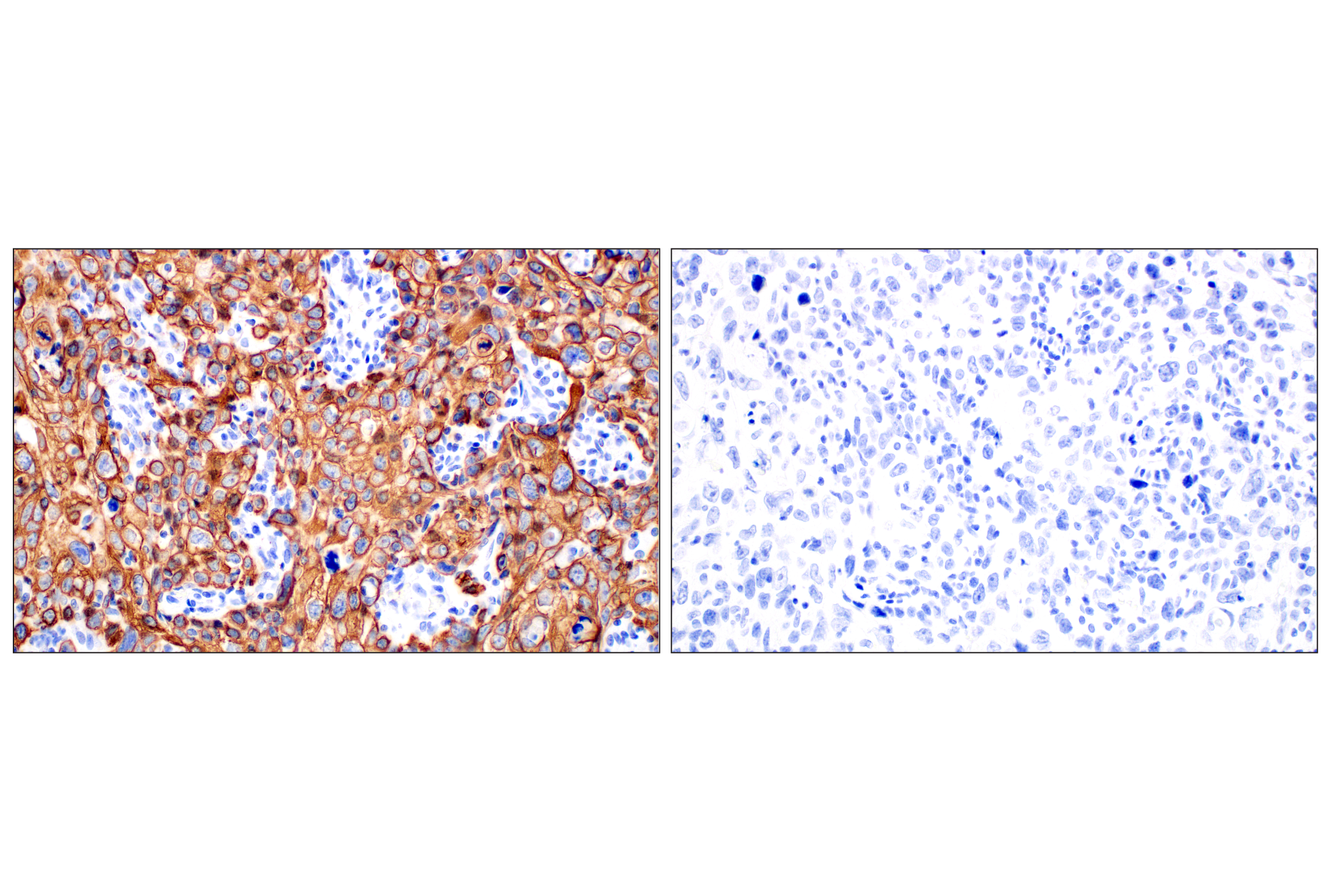 Immunohistochemistry Image 9: Keratin 14 (E7W6V) Rabbit mAb (BSA and Azide Free)