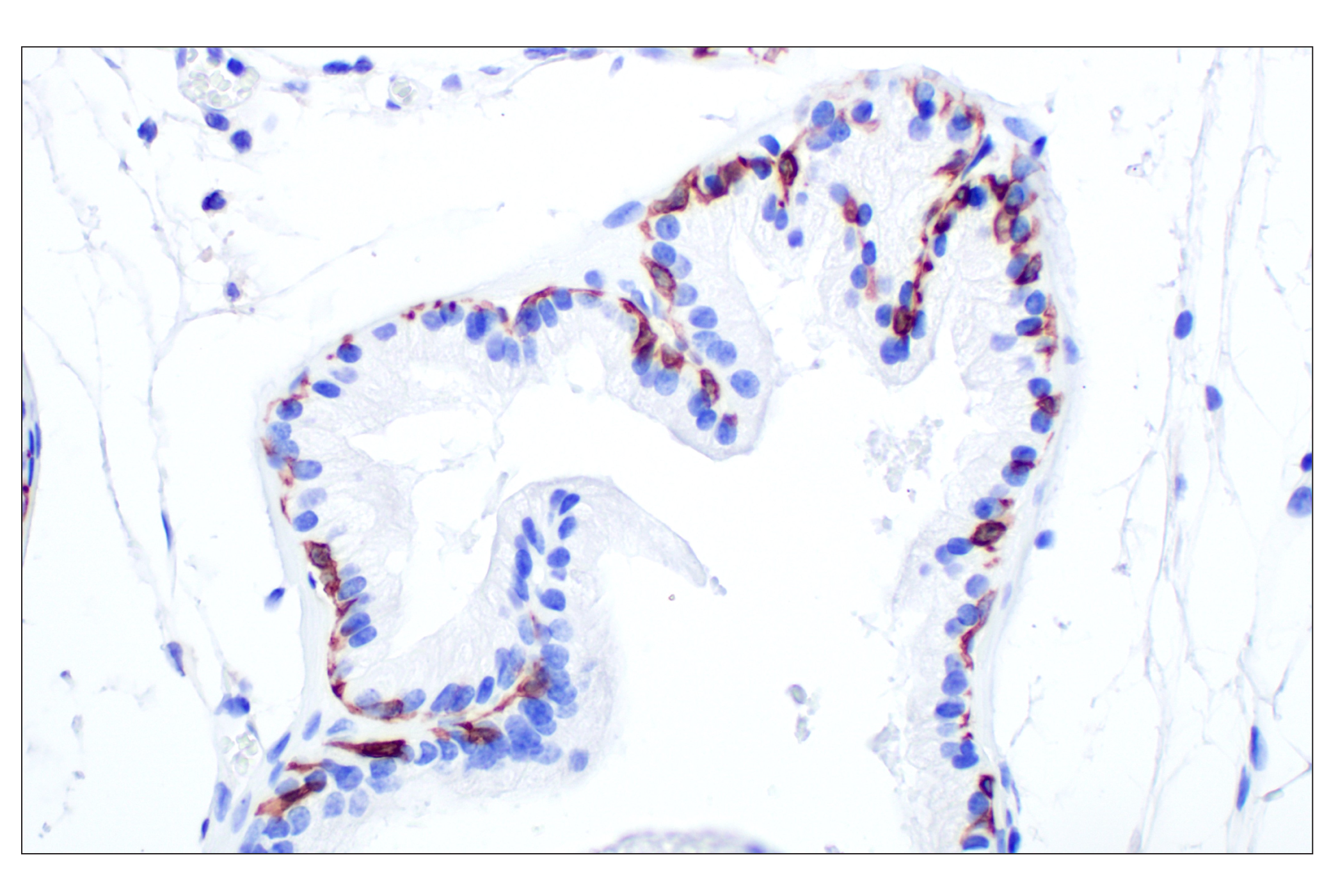 Immunohistochemistry Image 7: Keratin 14 (E7W6V) Rabbit mAb (BSA and Azide Free)