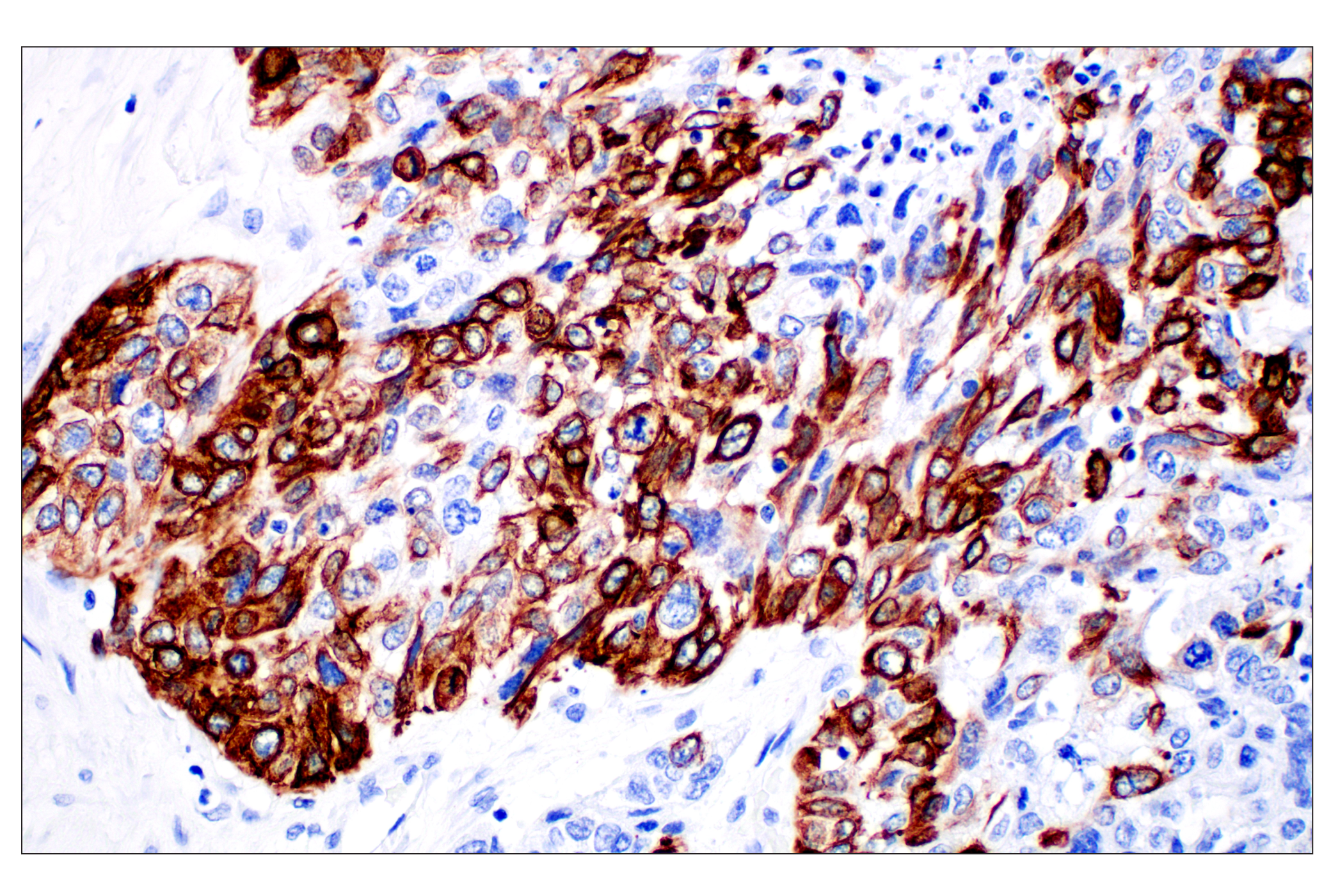 Immunohistochemistry Image 1: Keratin 14 (E7W6V) Rabbit mAb (BSA and Azide Free)