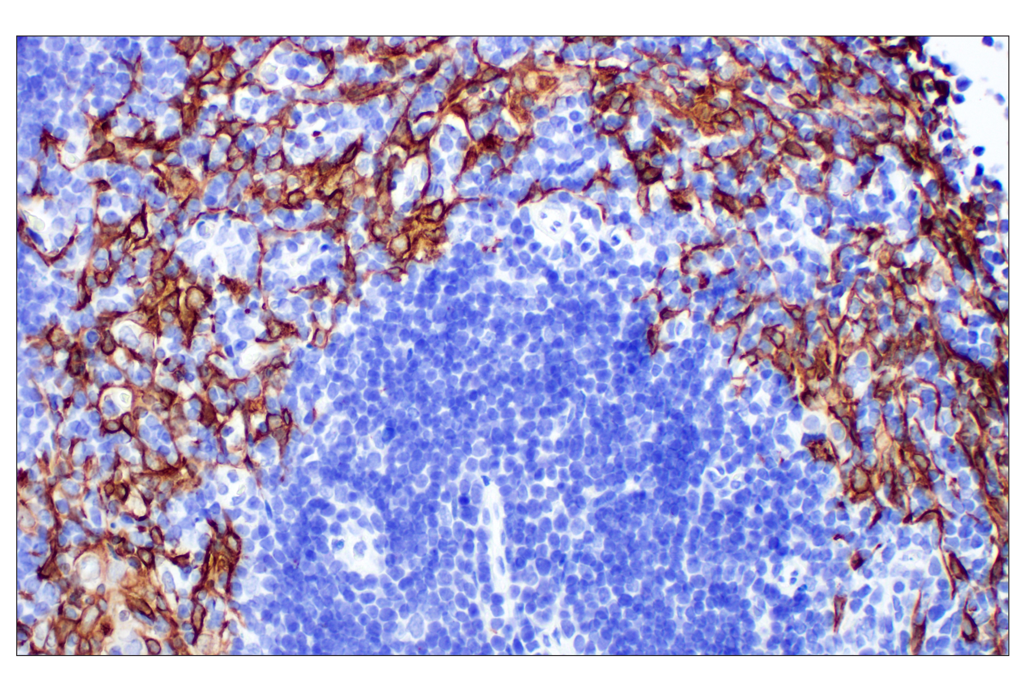 Immunohistochemistry Image 8: Keratin 14 (E7W6V) Rabbit mAb (BSA and Azide Free)