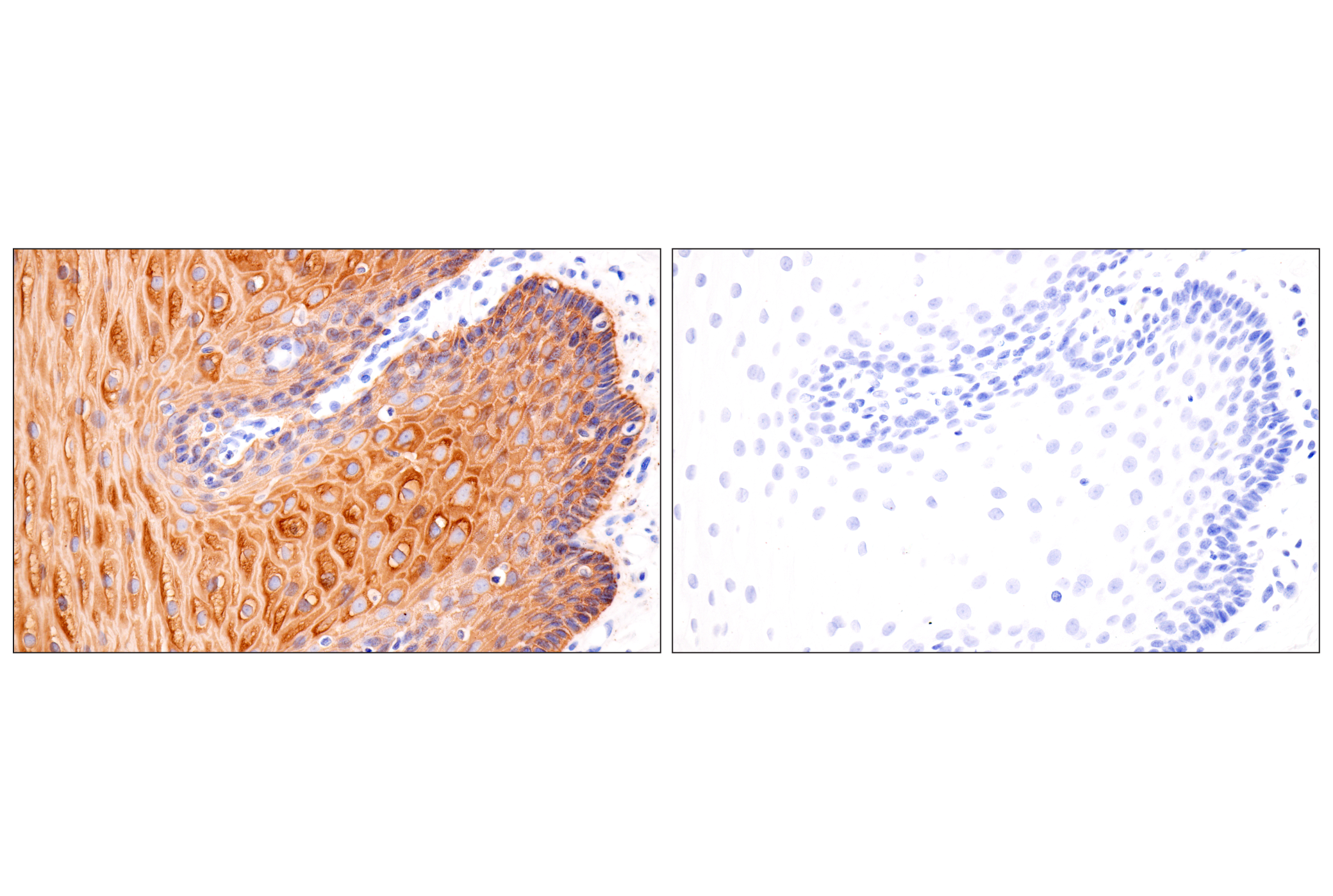 Immunohistochemistry Image 19: Pan-Keratin (Type II) (F6G1P) Rabbit Monoclonal Antibody