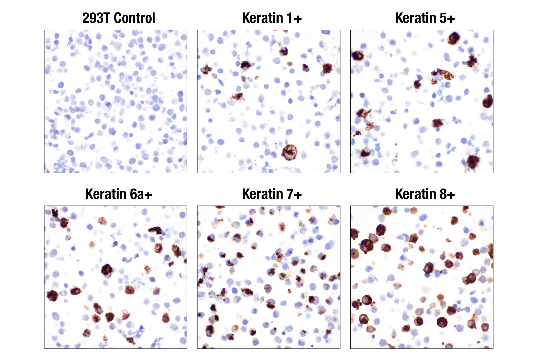 Immunohistochemistry Image 18: Pan-Keratin (Type II) (F6G1P) Rabbit Monoclonal Antibody