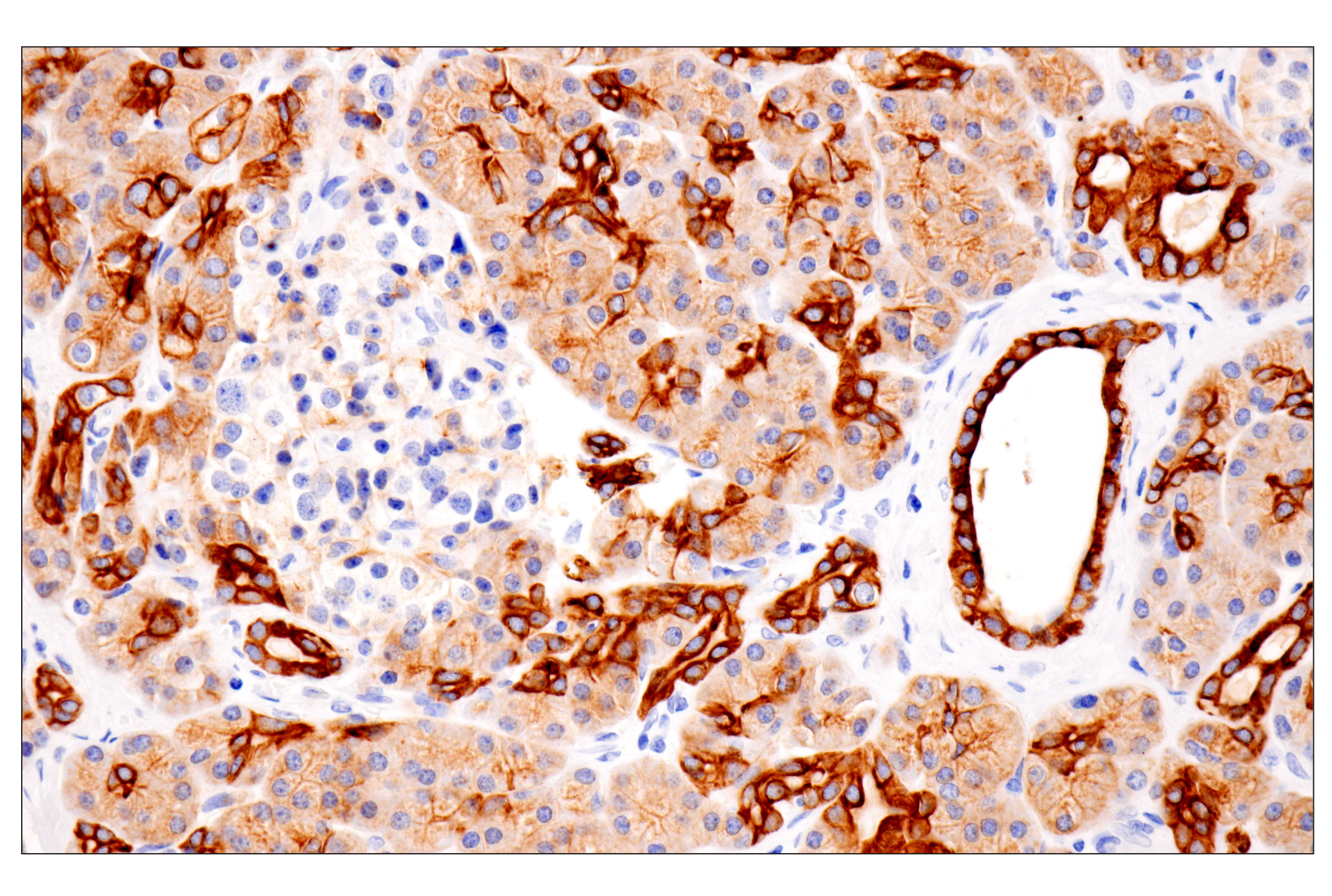 Immunohistochemistry Image 8: Pan-Keratin (Type II) (F6G1P) Rabbit Monoclonal Antibody