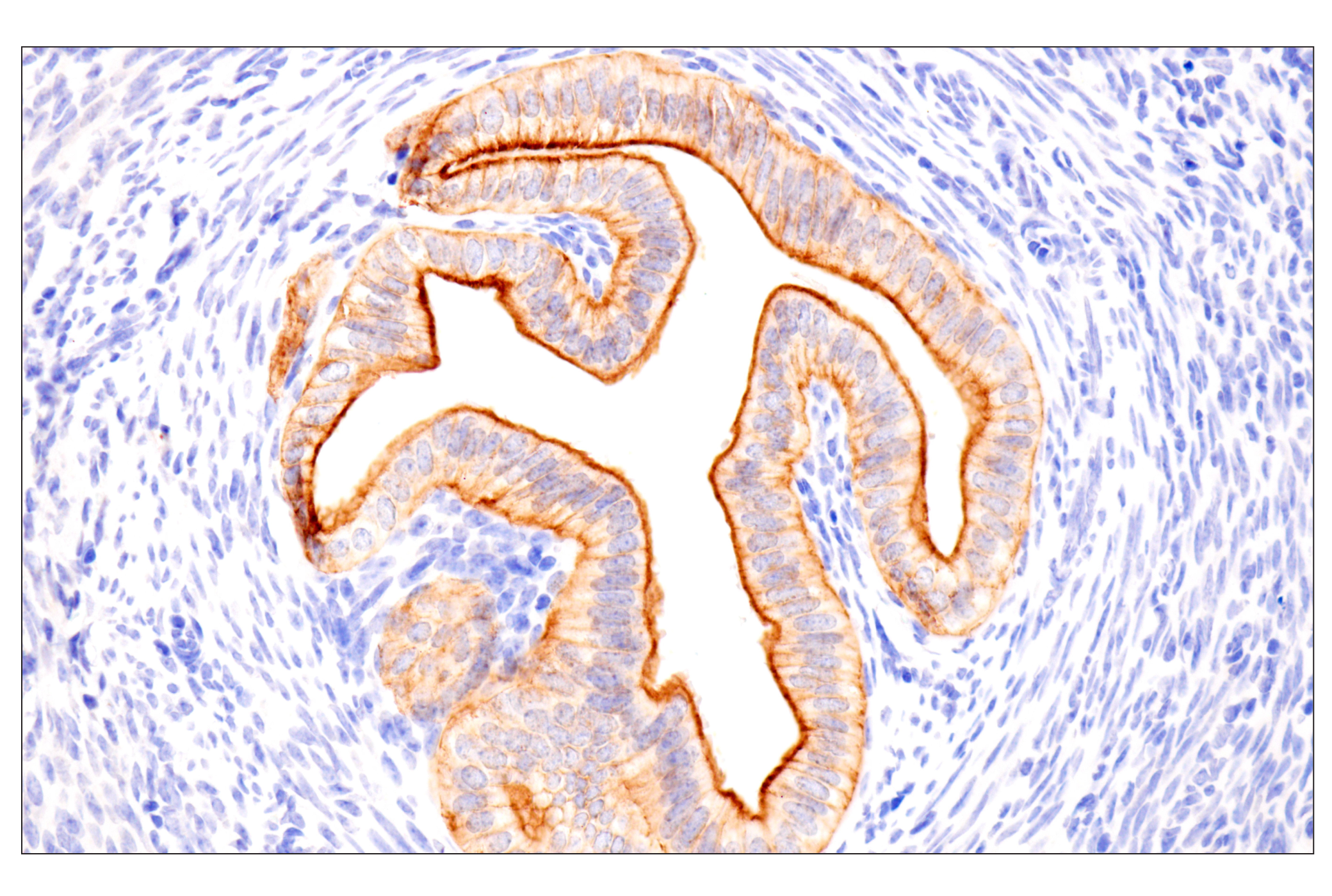 Immunohistochemistry Image 14: Pan-Keratin (Type II) (F6G1P) Rabbit Monoclonal Antibody