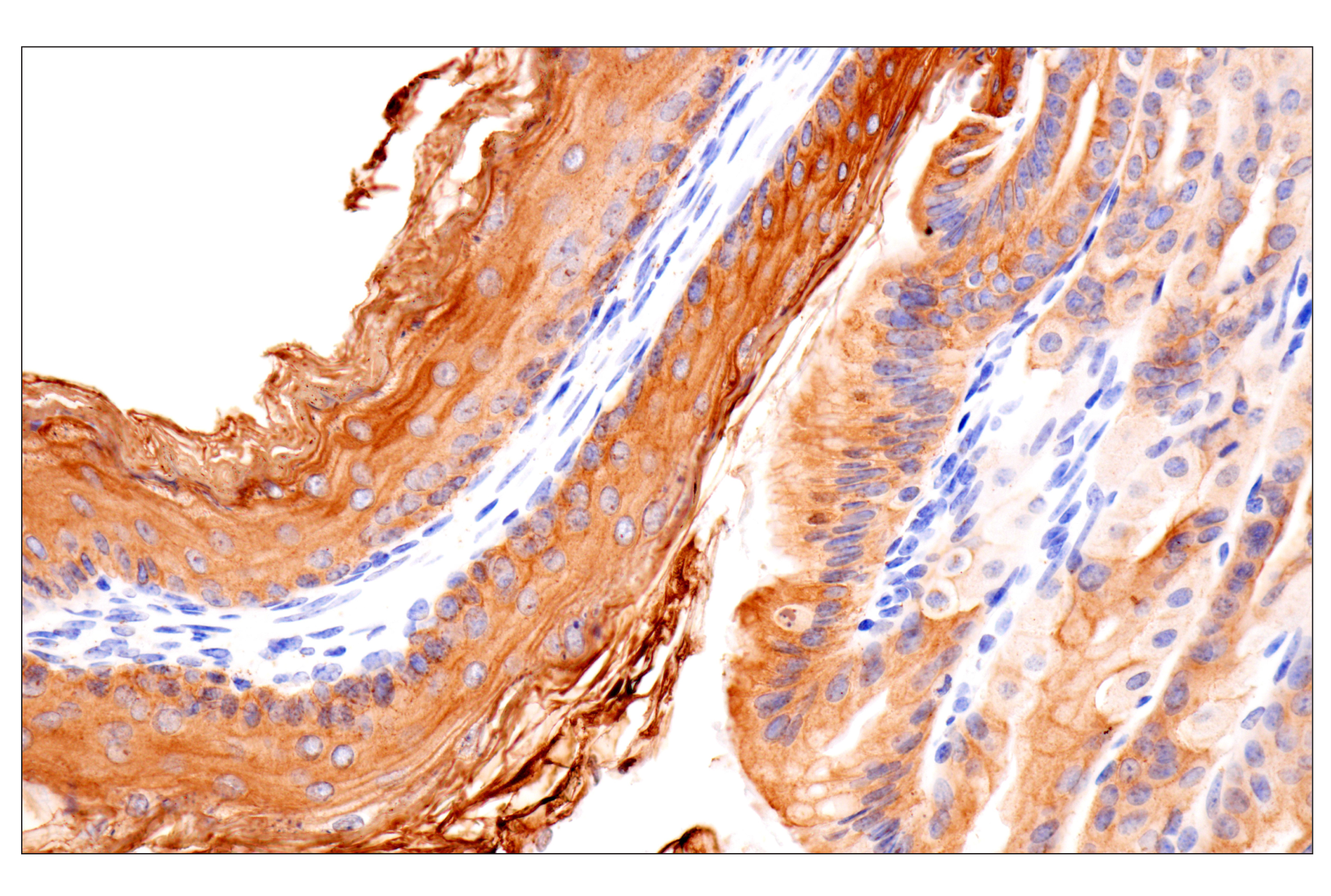Immunohistochemistry Image 17: Pan-Keratin (Type II) (F6G1P) Rabbit Monoclonal Antibody