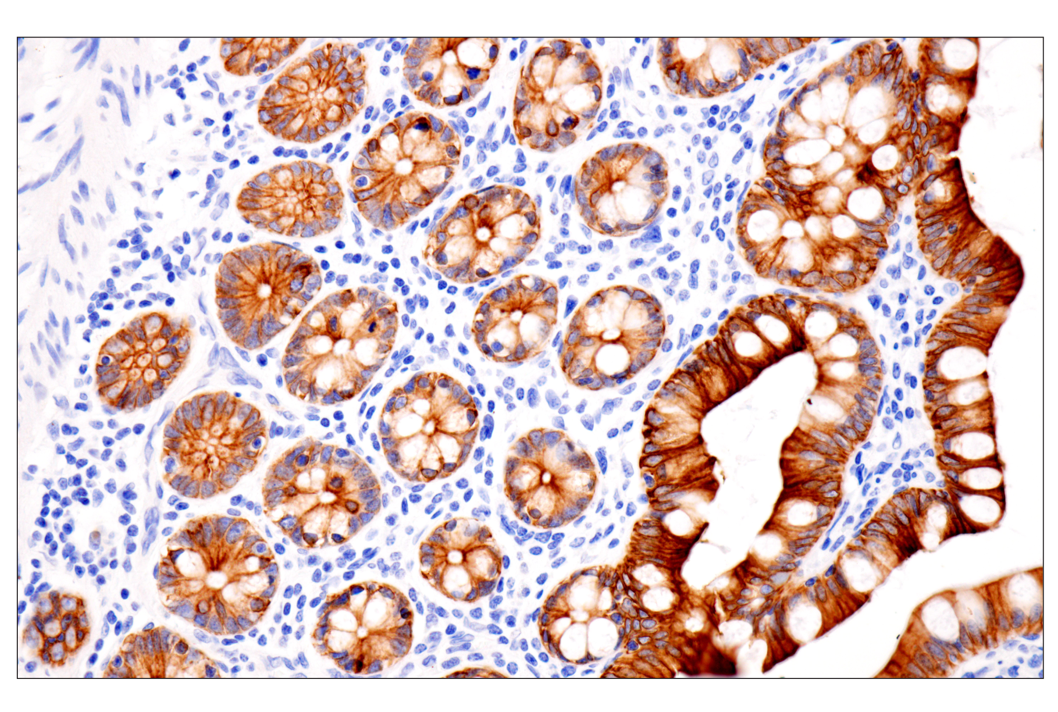 Immunohistochemistry Image 7: Pan-Keratin (Type II) (F6G1P) Rabbit Monoclonal Antibody