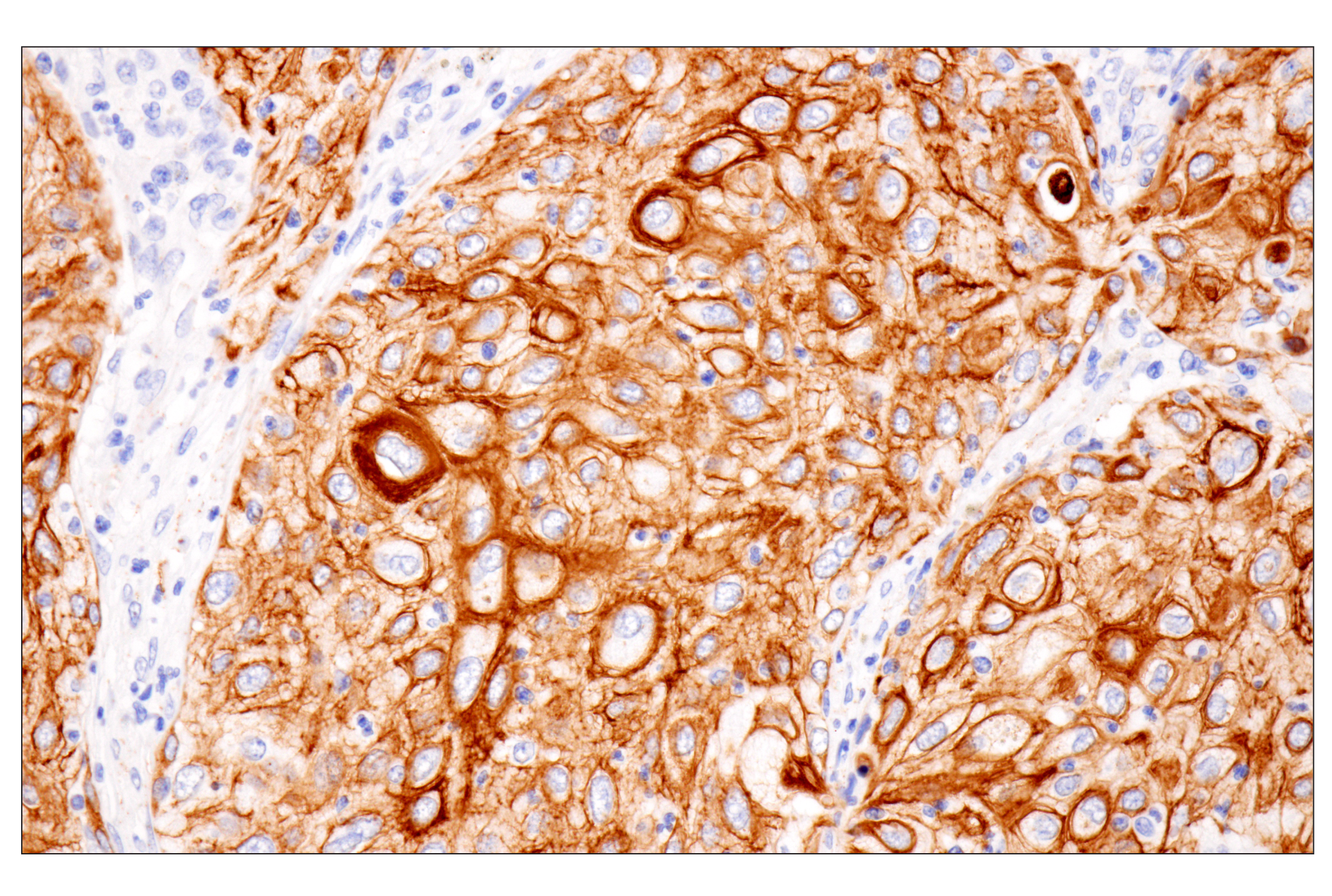 Immunohistochemistry Image 5: Pan-Keratin (Type II) (F6G1P) Rabbit Monoclonal Antibody