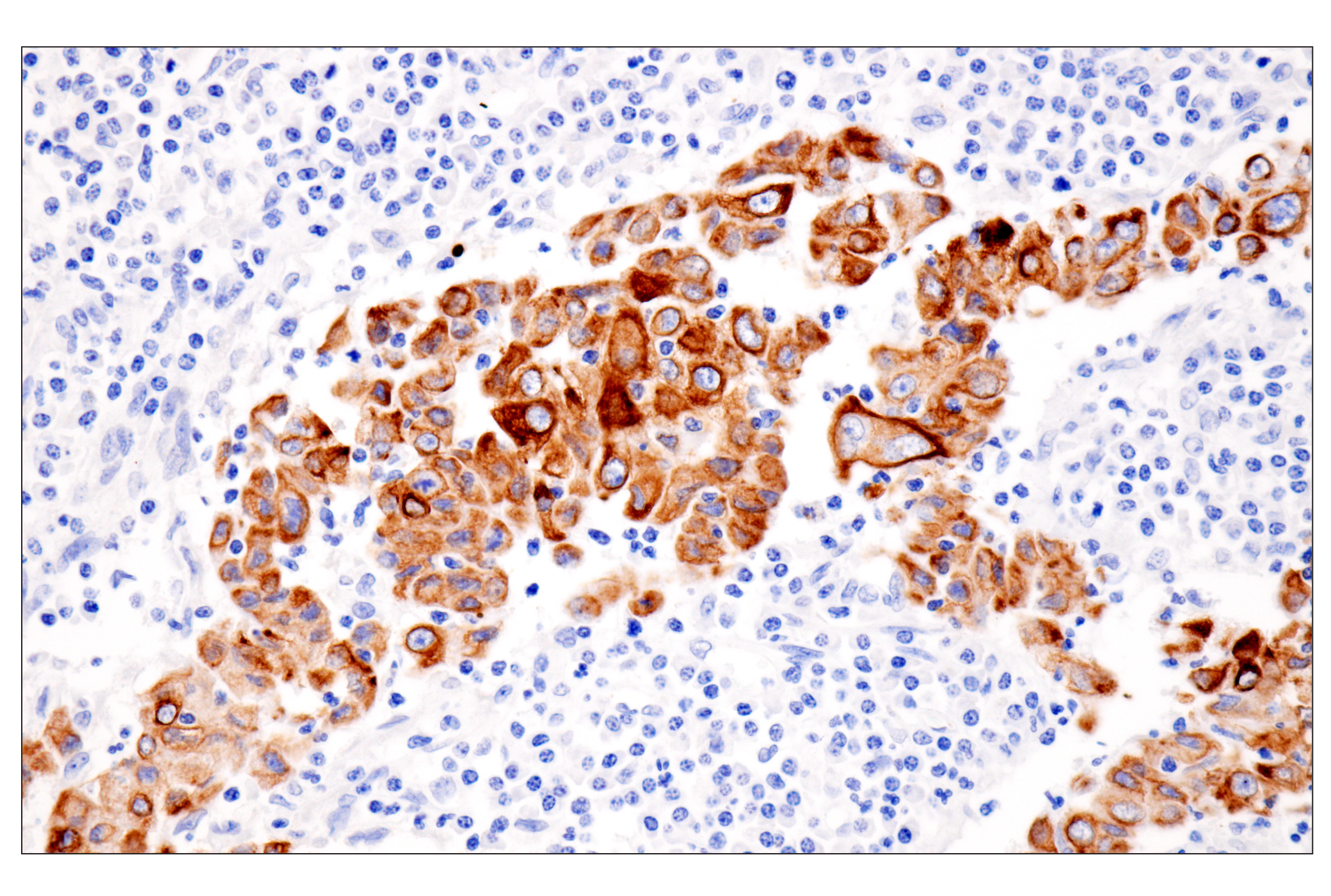 Immunohistochemistry Image 6: Pan-Keratin (Type II) (F6G1P) Rabbit Monoclonal Antibody
