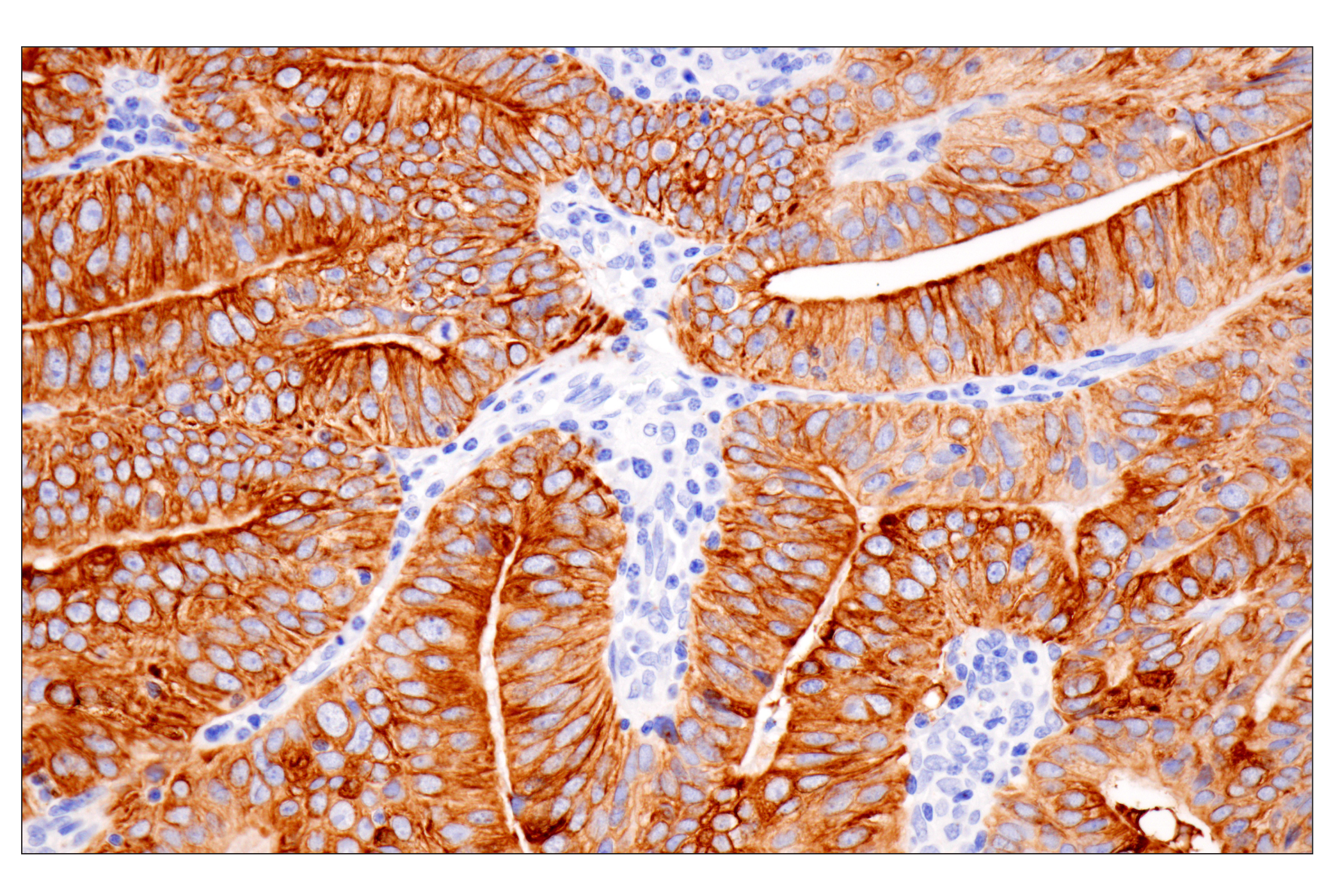 Immunohistochemistry Image 1: Pan-Keratin (Type II) (F6G1P) Rabbit Monoclonal Antibody