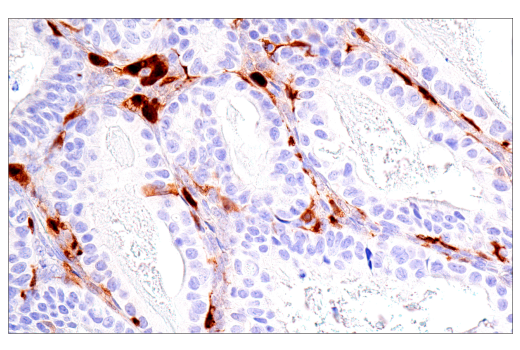 Immunohistochemistry Image 2: Calretinin (CAL6) Mouse mAb