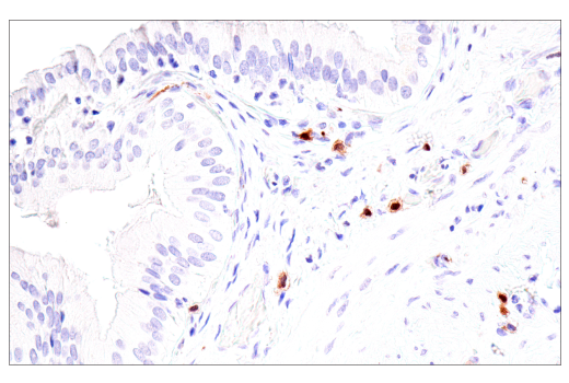 Immunohistochemistry Image 9: Calretinin (CAL6) Mouse mAb