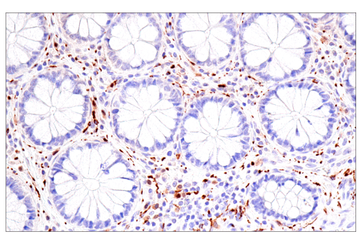 Immunohistochemistry Image 5: Calretinin (CAL6) Mouse mAb