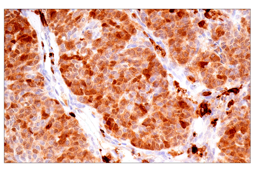 Immunohistochemistry Image 1: Calretinin (CAL6) Mouse mAb