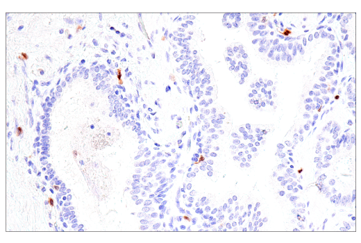 Immunohistochemistry Image 3: Calretinin (CAL6) Mouse mAb