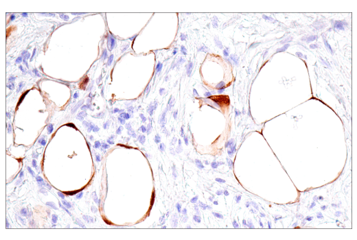 Immunohistochemistry Image 4: Calretinin (CAL6) Mouse mAb