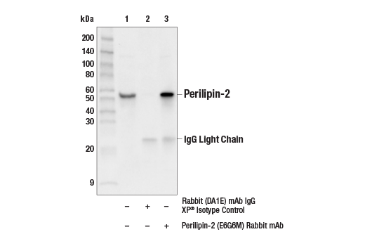 Immunoprecipitation Image 1: Perilipin-2 (E6G6M) Rabbit mAb