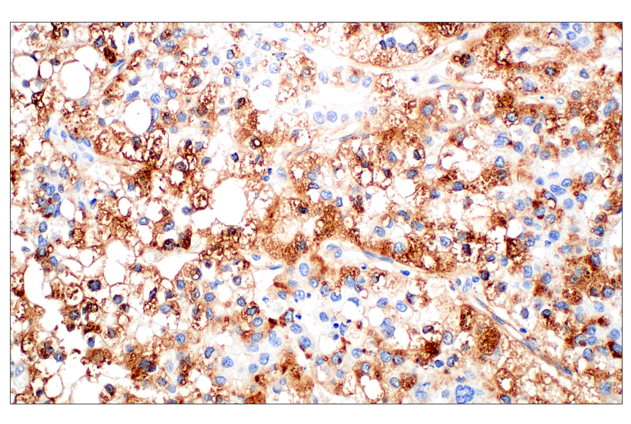 Immunohistochemistry Image 7: Perilipin-2 (E6G6M) Rabbit mAb