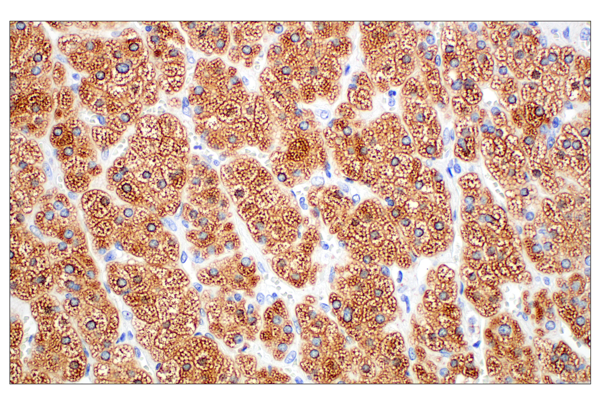 Immunohistochemistry Image 11: Perilipin-2 (E6G6M) Rabbit mAb