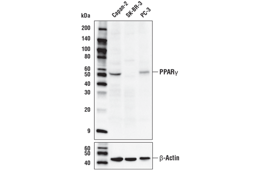 Western Blotting Image 1: PPARγ (D8I3Y) Mouse mAb
