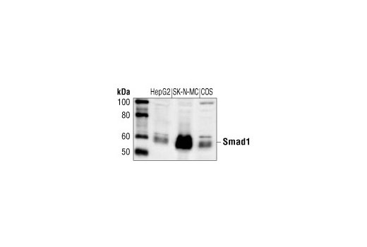 Western Blotting Image 1: Smad1 Antibody