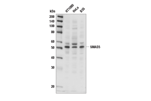 Western Blotting Image 1: SMAD3 Antibody