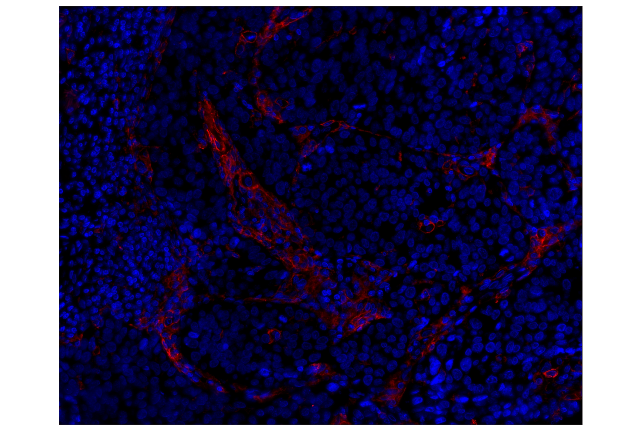 Immunohistochemistry Image 1: CD14 (D7A2T) Rabbit mAb (Alexa Fluor® 555 Conjugate)