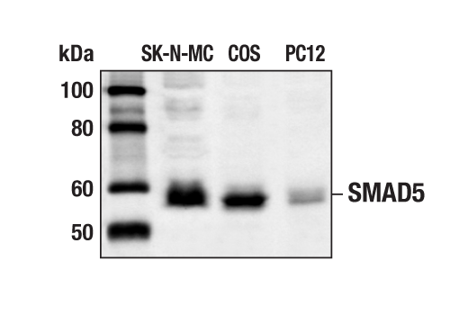 Western Blotting Image 1: SMAD5 Antibody