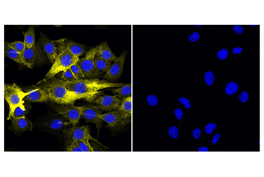 Immunofluorescence Image 2: CD44 (IM7) Rat mAb (Alexa Fluor® 555 Conjugate)