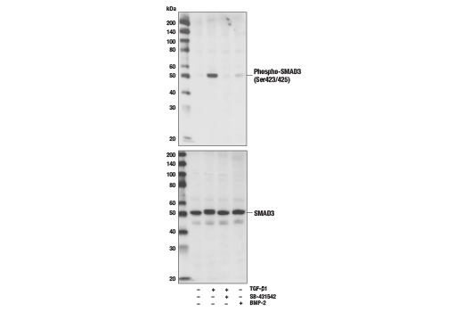  Image 18: SMAD2/3 Antibody Sampler Kit