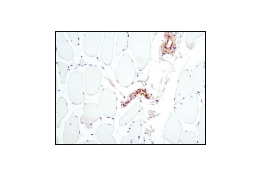 Immunohistochemistry Image 1: PKM2 (D78A4) XP® Rabbit mAb (BSA and Azide Free)