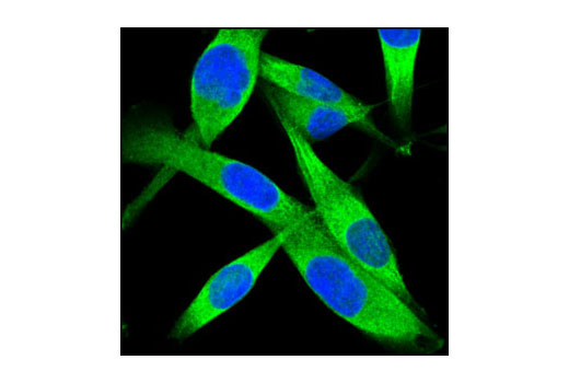 Immunofluorescence Image 1: PKM2 (D78A4) XP® Rabbit mAb (BSA and Azide Free)